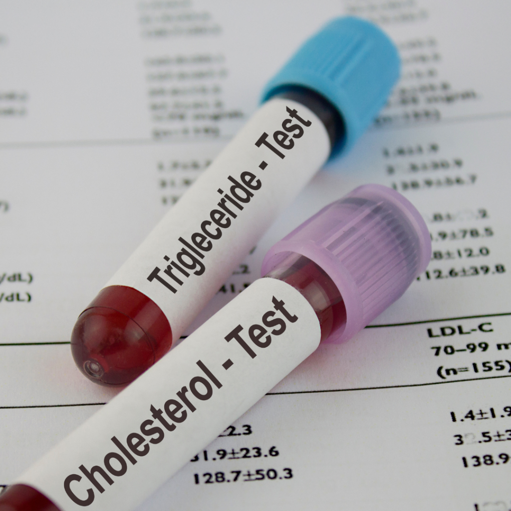 Bezplatné klinické studie a lékařské konzultace pro osoby s vysokým cholesterolem. Moderní léčba hypercholesterolémie.
